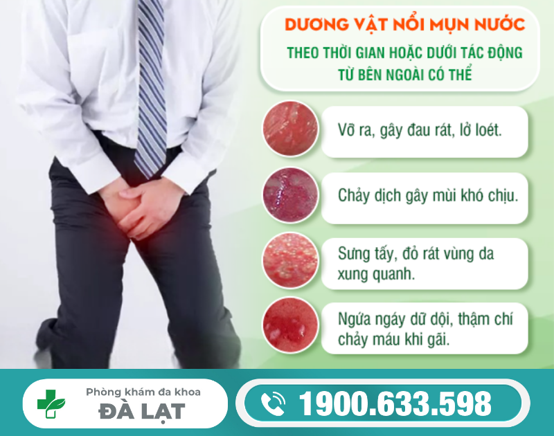 Hình ảnh minh họa